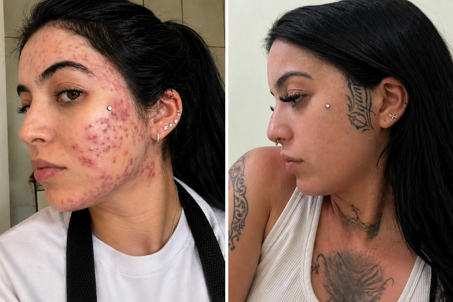 Resultado antes e depois 8